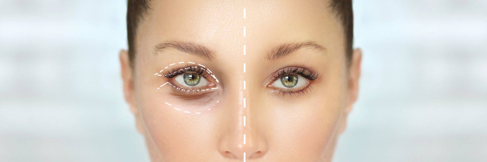 Sedm podrobných faktů o plastické operaci očních víček v MediEsté Clinic